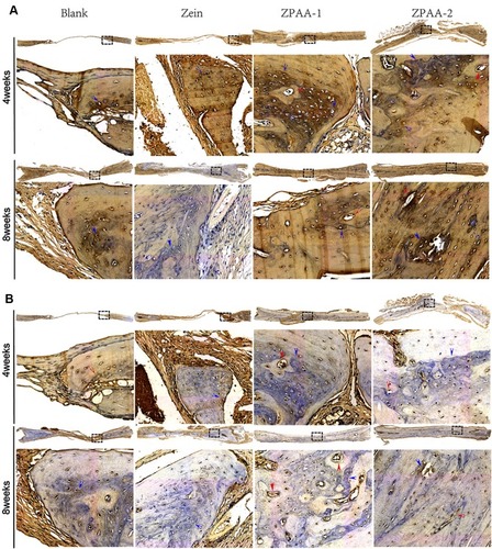 Figure 9 Immunohistochemical evaluations of bone regeneration in rat calvarial defects at 4 and 8 weeks postoperatively: (A) collagen type 1 staining and (B) osteocalcin staining. Blue arrows represent positive staining, red arrows represent vessels (1× and 40× magnification, scale bar = 100 μm).