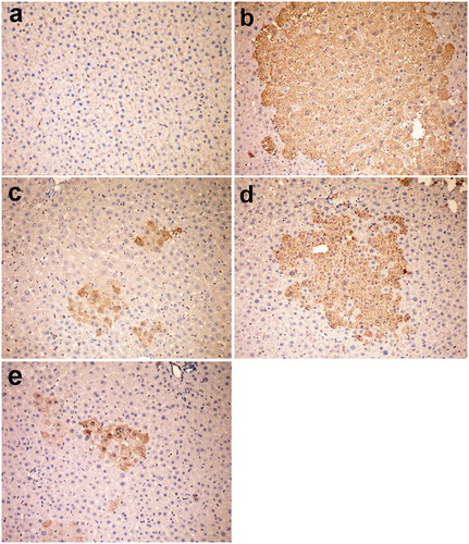 Figure 4. Liver, rat (38th week). (a) Negative staining for P-GST in group I (control group). (b) Large placental glutathione-S-transferase (P-GST) positive focus in group V injected with DENA. (c) Small-sized GST-P positive foci in group VI injected with DENA and treated with camel milk. (d) The medium-sized focus in group VII injected with DENA and treated with cisplatin. (e) Individual GST-P positive cells in group VI injected with DENA and treated with camel milk and cisplatin. Immunoperoxidase for GST-P 200 × (avidin–biotin–peroxidase complex method, Mayer’s Haematoxylin counterstain).