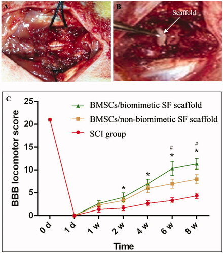 Figure 4. Spinal cord of rats was exposed (A), and a 3-mm SF scaffold seeded with BMSCs implanted into an SCI that was subsequently created (B). BBB scores indicate the significantly increased motor functional recovery of hindlimbs after the implantation of nanofibrous SF scaffold (C). Difference was considered statistically significant when *p < .05 compared with the SCI group, #p < .05 compared with the non-nanofibrous SF scaffold group.