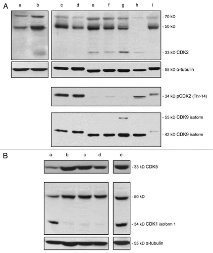 Figure 2 Expression of CDK2, pCDK2, CDK9, CDK5 and CDK1 in VGP and MGP melanoma cell lines, and in human neonatal melanocytes and skin fibroblasts. (A) Immunoblot analysis of CDK2, pCDK2, and CDK9 expression in the VGP melanoma cell line WM983-A (a), in MGP melanoma cell lines WM983-B (b), WM1158 (c), WM852 (d), WM266-4 (e), SK-MEL-28 (f), WM983-B (g), and in human foreskin-derived melanocytes (h), and human foreskin-derived fibroblasts (i). (B) Expression of CDK5 and CDK1 in MGP melanoma cell lines WM1158 (a), WM852 (b), WM266-4 (c), SK-MEL-28 (d), and WM983-B (e). For loading control, the immunoblots were probed with an antibody to α-tubulin.