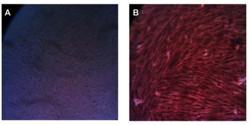 Figure 1 Morphological characteristics of the isolated stem cells of the apical papilla (40˟): (A) Stem cells of the apical papilla (SCAPs) at day 4 of the primary culture; (B) SCAPs reached conﬂuence at day 28.