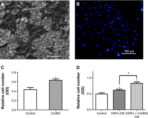 Figure 5 Biological effects of HUVECs induced by the Col/BG nanofibers cultured for 24 h.Notes: (A) SEM photographs of HUVECs. Magnification ×1000. (B) Fluorescence microscopy photographs of HUVECs. Magnification ×200. (C) The viability of HUVECs. (D) The proliferation of HUVECs cultured in the CM from HDFs grown on Col/BG nanofibers. The control group was cultured on cover slips. The results presented as the mean ± StD. *P<0.05 indicates statistically significant difference between the control and HDFs CM or (HDFs + Col/BG) CM groups, #P<0.05 indicates a significant difference between HDFs CM and (HDFs + Col/BG) CM groups.Abbreviations: CM, conditioned medium; Col/BG, collagen/bioactive glass; HDFs, human dermal fibroblasts; HUVECs, human vascular endothelial cells; OD, optical density; StD, standard deviation; SEM, scanning electron microscopy.