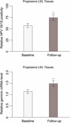 Figure 2. HPV 16/18 positivity rate and geminin mRNA expression in cervix tissues at baseline and follow-up time points of participants with progressive LSIL