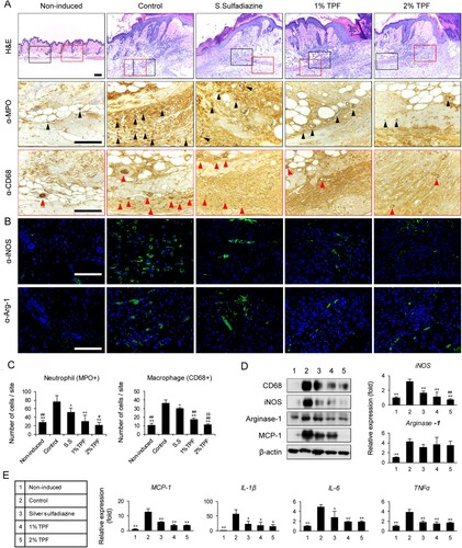 Figure 2. Topical application of TPF inhibits macrophage infiltration after cutaneous I/R injury. (A) Cutaneous pressure ulcer site into which the neutrophils and macrophages infiltrated 4 days after I/R injury, were stained with MPO and CD68 antibodies. Scale bar, 100 µm. (B) Cutaneous pressure ulcer site stained with iNOS (M1 macrophage) and Arg-1 (M2 macrophage) antibodies. Scale bar, 100 µm. (C) Neutrophil (MPO+) and macrophage (CD68+) cell counts. (D) Quantitation of iNOS and Arg-1 expression using RT-PCR and immunoblot 4 days after I/R injury. (E) Quantitation of the mRNA levels of MCP-1, IL-1β, IL-6, and TNFα 4 days after I/R injury. Scale bar: 100 µm. Data represent mean ± S.D. *p < 0.05 and **p < 0.01 vs. control, #p < 0.05 and ##p < 0.01 vs. silver sulfadiazine, $p < 0.01 vs. 1% TPF.