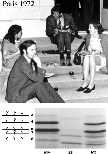 Figure 2. Laurell's initial finding soon inspired international research. Here at the Congress of Human Genetics in Paris in 1972 are, on the right Magne Fagerhol from Norway and Diane Cox from Canada, and in the foreground the author from New Zealand. The need at that time was to explain the complex electrophoretic banding of antitrypsin (below) which was categorised by Fagerhol and Cox with the Pi nomenclature Citation[22] and later shown Citation[109] with Jeppsson Citation[50] and others Citation[66]Citation[110], to be due to glycoforms and post‐translational changes as depicted to left.