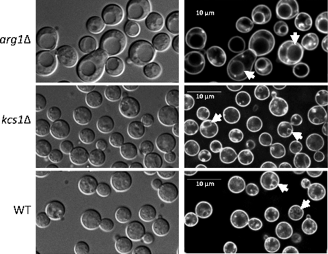 Figure 6. arg1Δ cells, but not kcs1Δ cells, are enlarged and produce bigger vacuoles. Cells were allowed to endocytose the lipophilic dye, FM 4–64, for 40 min to label vacuoles (indicated by arrows in panels on the right). Differential interference contrast images are shown on the left