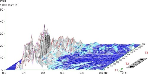 Figure 1 Typical three-dimensional chart of a spectral analysis of heart-rate variability during orthostatic load in the cardiac autonomic reactivity group.