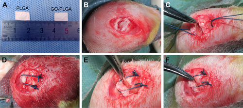 Figure S1 (A) General view of PLGA and PLGA-GO membranes and (B–F) surgical procedure of interposition of PLGA and PLGA-GO membranes in the rabbit supraspinatus tendon repair model.Abbreviations: GO, graphene oxide; PLGA, poly(lactic-co-glycolic acid).