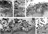 Fig. 1 Bacterial colonies adjacent to the normal gut epithelium of baboon (A–C), human (D), and rat (E) as observed by transmission electron microscopy. Biopsies from normal animals and from humans were fixed with glutardehyde, osmium, and uranyl acetate; embedded in epoxy resin; ultrathin sectioned; post-stained with uranyl acetate and lead citrate; and examined using an electron microscope. Both small, slender rod-shaped and large, ovoid, and thick rod-shaped bacteria were observed in the cecum of the baboon (A–C), whereas only larger bacteria were observed in the appendix of the human and the cecum of the rat. A matrix, or amorphous material surrounding the bacteria, was identified in all fields. Results are representative of 2 baboons, 2 humans, and 2 rats. The bar represents 2 μm.