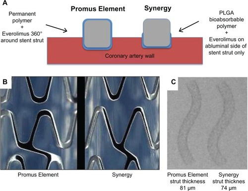 Figure 2 Key differences between the Promus Element and Synergy stent. In the thinner-strut Synergy stent, the drug and bioabsorbable poly-DL-lactide-co-glycolide (PLGA) polymer are applied to the abluminal stent surface only (A). The Synergy stent has different strut thickness, connector angle, and peak radius diameters, resulting in an enhanced stent platform (B). Panel (C) shows similar radiopacity between the stents despite reduced strut thickness in the Synergy stent.