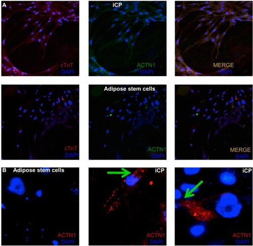 Figure 5 Analysis of cardiac-specific protein expression in iCPs.