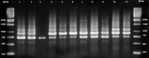 Figure 2 Variations in Candida albicans RPS types based on PCR amplification profiles using RPS primers.