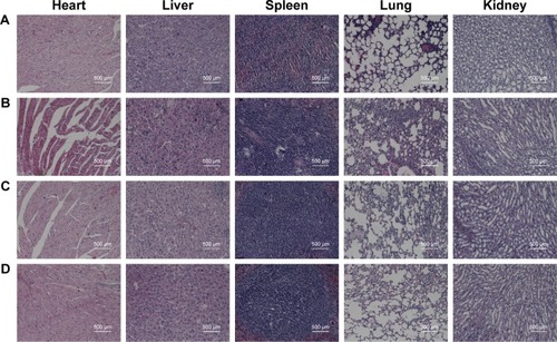 Figure 9 Histological observation of major organs (hearts, livers, spleens, lungs and kidneys) and tumor sections. The organs were collected from different groups after treatment with different formulations and were stained by H&E.Notes: (A) Normal saline (control), (B) DOX solution, (C) DOX/AuNCs-PM-HA and (D) DOX/AuNCs-PM-HA+NIR (1.5 W/cm2, 808 nm, 7 min) (DOX content at 2 mg/kg). The scale bars represent 500 μm.Abbreviations: AuNCs, gold nanocages; DOX, doxorubicin; DOX/AuNCs-PM-HA, DOX-loaded, PM-grafted and HA-modified AuNCs; DOX/AuNCs-PM-HA+NIR, DOX/AuNCs-PM-HA with NIR laser; HA, hyaluronic acid; NIR, near-infrared irradiation; PM, copolymer of N-isopropylacrylamide and acrylamide.