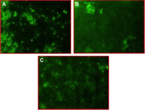 Figure 9 Confocal laser scanning microscopy images.Notes: (A) LNCaP, (B) DU-145, and (C) PC3 cell lines, after 120 minutes incubation with FITC-loaded NPs at 37.0°c. The NPs’ internalization is observed as green fluorescence of FITC. Magnification 20×.Abbreviations: NPs, nanoparticles; FITC, fluorescein isothiocyanate.