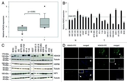 Figure 1. HDAC6 expression in urothelial cancer cell lines and tissues. (A) Relative HDAC6 expression in cancerous (T) and normal (N) tissues was determined by quantitative real-time PCR analysis and displayed as box-plots. P value was calculated by Mann–Whitney U test. HDAC6 expression values were normalized to TBP as reference gene. (B) Relative mRNA expression of HDAC6 in urothelial cancer cell lines (T) and normal proliferating uroepithelial cell cultures (N, UEC) was measured by quantitative real-time PCR analysis. The dotted line displays the average expression level of the UEC samples. hTERT is an immortalized normal urothelial cell line. HDAC6 protein expression was analyzed in cell lines by western blotting (C; HDAC6 at 131 kDa, α-Tubulin at 50 kDa). Expression of HSP90 and HIF1α was determined in the same manner (C). Immunofluorescence stainings (D) were performed for cell lines with, respectively, high (RT-112, 639-V, 253J), moderate (5637), and low (BFTC-905, VM-CUB1) HDAC6 protein expression. HDAC6 is stained green (FITC); nuclei are stained blue (DAPI). White arrows indicate positively stained filopodia; accumulation of perinuclear speckles in cell lines with a more epithelial phenotype (5637 and RT-112) are highlighted by white arrowheads.