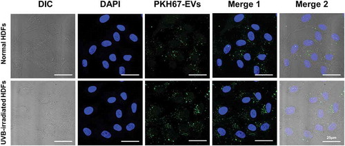Figure 4. The cellular uptake of HASC-derived EVs in normal and UVB-irradiated HDFs. Light differential interference contrast (DIC) and corresponding confocal images of HDFs after 3 h incubation with 1 × 108 particles/mL of PKH67-labelled EVs, respectively (n = 3). Images of PKH67-labelled EVs (green) with DAPI (blue) were visualized by merging the confocal images (Merge1) or bright-field with confocal images (Merge2). Scale bars represent 25 μm.