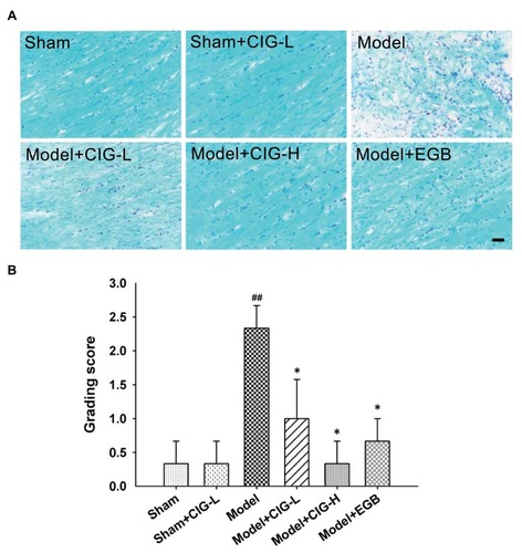 Figure 2 Effects of CIG on white matter lesions in the corpus callosum of MCAO rats measured by LFB staining.