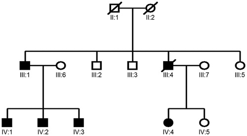 FIGURE 1. Pedigree of the Northern Irish family affected with thoracic aortic aneurysms and dissections (TAAD) due to a heterozygous mutation (p. Arg149Cys) in ACTA2. All living affected members had iris flocculi (of varying degree; see Figure 2) and the p.Arg149Cys ACTA2 mutation. IV:1 and IV:3 had thoracic aneurysms requiring repair confirming that iris flocculi are an ocular marker of TAAD.