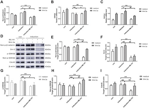 Figure 3 (A–C) Effect of ML141 and Wnt-3a on β-catenin, GSK3β, and TCF7L2 mRNA expression. qPCR detected the mRNA expression of (A) Non-p-β-catenin, (B) GSK3β, (C) TCF7L2 in IPCs after induction with Wnt-3a or ML141 administration. (D-I) Effect of ML141 and Wnt-3a on non-p-β-catenin, Dvl-2, p-GSK3β, non-p-GSK3β, and Cdc42 protein expression. Western blot measured the protein expression of (E) non-p-β-catenin, (F) Dvl-2, (G) p-GSK3β, (H) non-p-GSK3β and (I) Cdc42 in IPCs after induction with Wnt-3a or ML141 administration. Data were shown as the mean ± SD, n = 3. Values were significantly different compared with the corresponding control values at **p<0.01, *p<0.05, ##p<0.01 and #p<0.05.