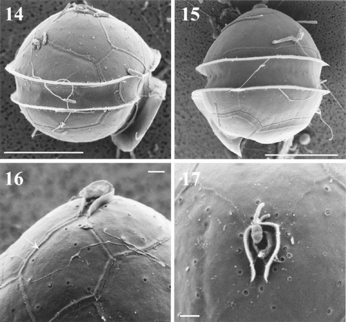 Figs 14 – 17. Oblea rotunda observed under SEM. Lateral views and detail of the apical pore complex (APC). Scale bars represent 10 μm in Figs 14 – 15, and 1 μm in Figs 16 – 17. Fig. 14. Right lateral view showing the sulcal list. Note the presence of bacteria on the surface of the cell. Fig. 15. Left lateral view. Fig. 16. Detail of the first apical plate (arrow) showing its meta pattern and the APC. Fig. 17. Detail of the apical pore and canal plate on a cell with 4 apical plates. Note the small perforations surrounding the APC.