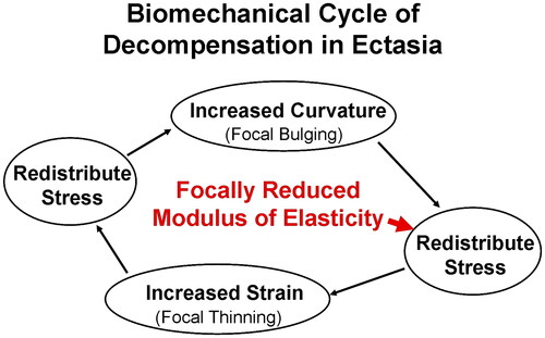 Figure 6. The biomechanical cycle of decompensation in ectasia is shown with the initiating event the focal reduction in elastic modulus that leads to a redistribution of stress, which generates thinning as the cornea strains, leading to another redistribution of stress. The cornea responds with an associated focal increase in curvature that again redistributes the stress. The cycle continues as the ectasia progresses. Adapted from Roberts and Dupps.Citation19