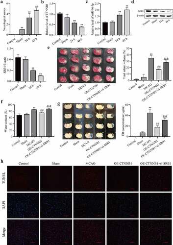 Figure 6. CircCTNNB1 and SRB1 are involved in cerebral IRI in vivo. (a) Neurological severity score. (b and c) RT-qPCR assessed the expression of circCTNNB1 and miR-96-5p. (d) Western blotting measured SRB1 protein expression. (e) 2,3,5-Triphenyltetrazole chloride staining. (f) Water content. (g) Evans blue staining. (h) TUNEL revealed cell apoptosis in MCAO mouse brains. Scale bar = 100 Dm. **P < 0.01 vs. Control; ##P < 0.01 vs. MCAO; &&P < 0.01 vs. OE-CTNNB1.