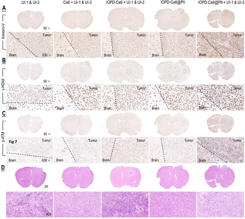 Figure 7. Sonotoxicity of GBM mediated by sono-activated IOPD-Ce6@Plt. IHC staining of annexin-V (A) (marker of apoptosis) and γH2AX (B), p-ATM (C) (markers of DNA damage) and H&E staining (D) in GBM tumors at the end of therapy. Treatment protocol is shown in Figure 6(A).