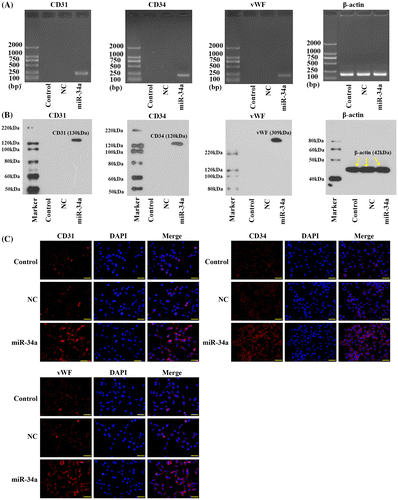 Fig. 3. Transfection with miR-34a mimics induced the expression of endothelial markers in CD133 + U251 cells. (A) Representative images of RT-PCR validation of the expression of endothelial markers: the expressions of CD31, CD34, and vWF were observed only in the CD133 + U251 cells transfected with miR-34a. (B) Representative images of western blotting validation of expressions of endothelial markers: the expressions of CD31, CD34, and vWF were observed only in the CD133 + U251 cells transfected with miR-34a. (C) Representative images of immunofluorescent staining of the three endothelial markers: more immunofluorescent positive cells were observed in CD133 + U251 cells transfected with miR-34a. Scale bar, 50 μm.