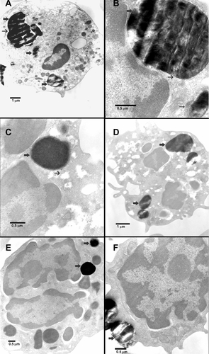 Figure S1 Transmission electron microscopic images of fetal blood mononuclear cells incubated with 500 μg/mL MCM41-cal for 2 hours. (A) MCM41-cal particles were seen within vacuoles (thick arrows), in the cytosol of a macrophage, not obviously attached to any organelle. (B) MCM41-cal was seen within a vacuole (thin arrow) and strictly attached to the nuclear membrane of a macrophage with clear invagination of the nuclear membrane in the area of adherence without obvious damage (thick arrow), another MCM41-cal was seen adherent to a mitochondrion without any obvious damage (thin arrow). (C) MCM41-cal was in a neutrophil polymorph, within a vacuole (thick arrow), adhering to the nucleus and mitochondria (thin arrow) without causing any obvious damage. (D) MCM41-cal particles were in the cytosol of a neutrophil polymorph, within vacuoles and close to mitochondria (thick arrow). (E) MCM41-cal was seen in the cytosol of a neutrophil polymorph closely adhering to the nucleus (thick arrow) and another particle was seen passing the cell membrane without any obvious damage (thick arrow). (F) Two MCM41-cal particles were seen in the cytosol of a lymphocyte after crossing the cell membrane without any obvious damage (thick arrow).
