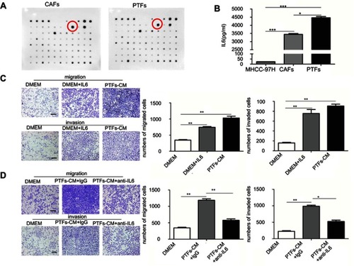 Figure 2 PTFs promoted the progression of HCC mainly by secreting Interleukin 6.Notes: (A) The profiles of the cytokines secreted from CAFs and PTFs was examined by using the RayBio Human Cytokine Antibody Array. The most significantly increased chemokine IL-6 was marked. (B) Elisa assay was performed to detect the amount of soluble IL-6 in each group. (C) MHCC-97H cells cultured with DMEM containing soluble IL-6 (40 ng/ml) were assessed by transwell assay. (D) IL-6 neutralizing antibody decreased the effect of PTFs-CM on the migration and invasion of MHCC-97H cells. Scale bar, 200 µm. Data are shown as mean ± SD from at least three independent experiments (*P<0.05, **P<0.01, ***P<0.001).Abbreviations: CAFs, cancer-associated fibroblasts; CM, conditioned medium; HCC, hepatocellular carcinoma; PTFs, peri-tumor fibroblasts.