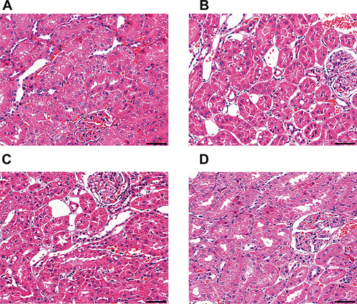 Figure 4 Renal histopathology of rats exposed to different AR products as observed by H&E staining. (A) N group, (B) CAR group, (C) ARP group, (D) ACB group. Scale bar: 50μm.