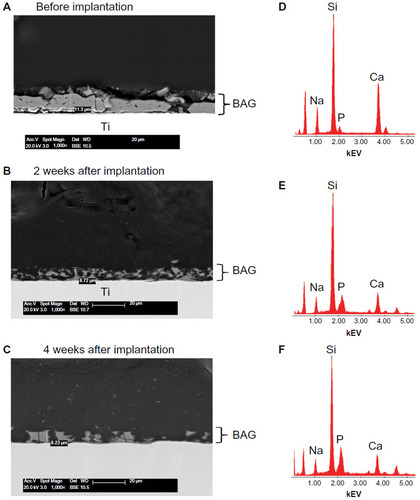 Figure 4 Scanning electron microscope images of a bioactive glass coating at different time-points.