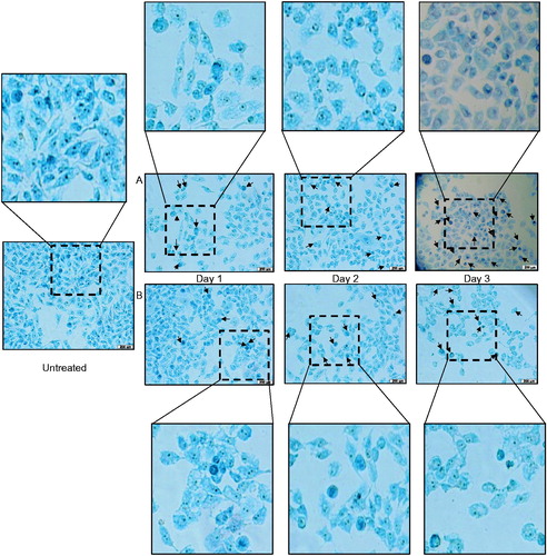 Figure 2. Morphological changes caused by C. nutans extracts on MCF-7. Cells were treated with (a) ethyl acetate and (b) methanol root extracts of C. nutans at their respective IC50 value for up to three days. Cells were stained with methylene blue and observed under microscope with 40x magnification. Arrows indicate some cells with morphological changes when compared with untreated cells.