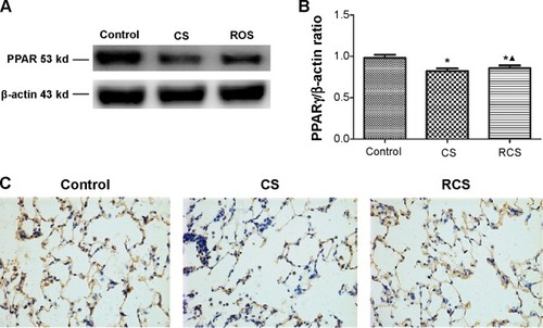 Figure 1 Effects of cigarette smoke (CS) with the treatment rosiglitazone on the protein expression of PPARγ.Notes: CS stimulation caused the decreased expression of PPARγ (CS group) when compared to the control group, while the treatment of rosiglitazone caused the partial recovery of PPARγ (RCS group). (A) The protein expression of PPARγ as measured by Western blotting; (B) the target protein bands densitometrically analyzed, normalized to β-actin; (C) the protein expression of PPARγ measured by immunochemistry staining (×400 magnification) in the control group, CS group, and RCS group. *P<0.05, compared with the control group; ▲P<0.05, compared with the CS group.Abbreviations: PPARγ, peroxisome proliferator-activated receptor γ; RCS, rosiglitazone-cigarette smoke.