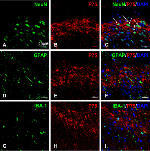 Figure 5 The cellular localization of p75NTR in spinal cord after CFA intraplantar injection. (A–C) Double staining of p75NTR (red, (A)) with NeuN (green, (B)) in the ipsilateral spinal cord dorsal horn at post-injection day 1. Note p75NTR positive staining surrounds NeuN positive staining. Arrows indicate co-localization of p75NTR and NeuN. (D–F) Double labeling of p75NTR (red, (E)) with Iba1 (green, (D)) at day 1 post-injection. (G–I) Double staining of p75NTR (red, (H)) with GFAP (green, (G)) in the ipsilateral spinal cord after CFA injection at day 1. Scale bars= 20 µM.