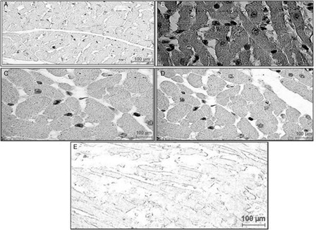 Figure 6. Immunohistochemical findings of Bcl-2 protein in the rat myocardium from different experimental groups. The localization of Bcl-2 protein is indicated by dark brown positive immunoreactivity. (A) ISP-treated control rats, showing lesser bcl-2 immunoreactivity than healthy controls; (B) healthy control rats, showing positive bcl-2 immunoreactivity in the myocytes; (C) HETA-treated rats, showing up-regulation in the expression of bcl-2 relative to ISP-treated controls; (D) α-tocopherol-treated rats, showing bcl-2 up-regulation relative to ISP-treated controls; (E) HETA + α-tocopherol combination, showing up-regulated bcl-2 expression relative to ISP-treated controls.