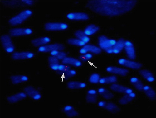 Figure 1.  Detection of the site of insertion by fluorescent in situ hybridization. Metaphase chromosomes were isolated from homozygous transgenic mouse lymphocytes and fixed onto slides. The site of insertion was detected using a fluorescently labeled cosmid clone hp3.1 (red and arrows). Individual chromosomes were identified by DAPI banding. FISH signals from 100 fields were observed under fluorescence. The hybridization signal was localized to mouse chromosome 19, region C3.
