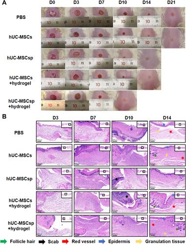 Figure 4 Wound healing behaviors with different treatments. (A) Representative photo micrographs of wounds when treated with different treatments administered for various durations. The inner diameter of initial wound was 8 mm. (B) Hematoxylin and eosin (H&E) stained images of wounds with different treatments after 3, 7, 10, and 14 days. Green arrow: follicle hair, black arrow: scab, red arrow: red vessel, blue arrow: epidermis, and orange arrow: granulation tissue. Scale bar: 200 µm.