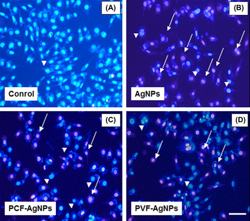 Figure 7. Representative fluorescence microscopy images showing the necrotic L929 cells after interaction with: (A) only medium or the plain fabrics (no AgNPs); (B) AgNPs nanoemulsions; (C) PCF loaded with AgNPs; and (D) PVF loaded with AgNPs. The healthy cells look all blue (stained with the Hoechst 33342 dye) – means no necrotic effect. The red color (stained with propidium iodate) demonstrates the necrotic cells (indicated also with arrows). Magnifications are 200x and the scale bar is 40 μ.