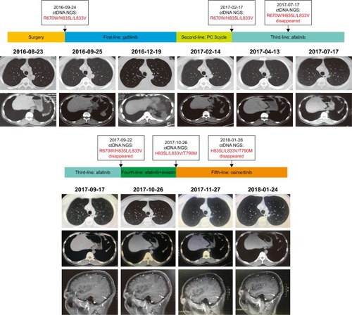 Figure 3 Treatment of lung adenocarcinoma using different regimens, and the results of monitoring the NGS of cfDNA.
