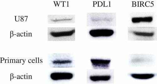 Figure 1. The expression of WT1, BIRC5 (survivin) and PDL1 on human glioblastoma cells. The expression levels of WT1, BIRC5 and PDL1 on U87 cell line and primary GBM cells were confirmed by western blot. The U87 cell line showed high expression of BIRC5 while primary GBM cells expressed WT1 and PDL1. β-actin was used as an internal control in all western blot experiments. The figure is made up of multiple gel images; full-length blots are presented in supplementary figure. U87 cell line: human glioblastoma cell line; Primary cells: human primary glioblastoma cells