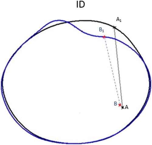 Figure 3. Calculation method for the ID deflections. A and B refer to the origin in the undeformed and deformed contours. The peak deflection is the difference between the vectors AA1 and BB1. Refer to the text for details.