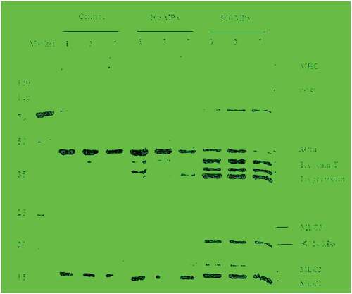 Figure 6. SDS-PAGE profile of myofibrillar proteins of untreated samples and 200 MPa and 500 MPa treated samples for 15 min at 18 °C with storage time.MHC, myosin heavy chain; α-act, α-actinin; MLC, myosin light chain.Figura 6. Perfil de SDS-PAGE de las proteínas miofibrilares de las muestras no tratadas y de las muestras tratadas a 200 y 500 MPa durante 15 minutos a 18°C con tiempo de almacenamiento
