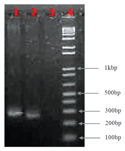Figure 1 PCR amplified products of RT domains of Ty1-copia and Ty3-gypsy retrotransposons of jute genome. Lane 1: Ty3-gypsy PCR products, Lane 2: Ty1-copia PCR products, Lane 3: Control PCR without template, Lane 4: 1 Kb+ ladder. Genomic DNA was isolated from mature leaves of jute variety O-9897 and after PCR amplification, the PCR amplified products were run in 2% agarose gel.