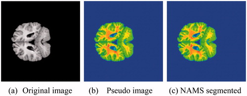 Figure 3. NAMS segmentation of brain MR image.