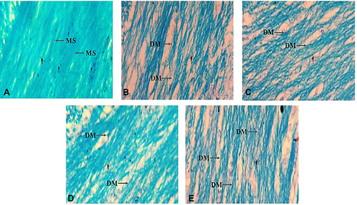 Figure 7 Photomicrograph from the cerebral cortex of Wistar rats from the different treatment groups. Normal control (A), 1mg/kg (low dose of dihydrocodeine) treated group (B), 2mg/kg (high dose of dihydrocodeine) treated group (C), 2mL/kg (low dose of codeine) treated group (D), 4/mL/kg (high dose of codeine) treated group (E).