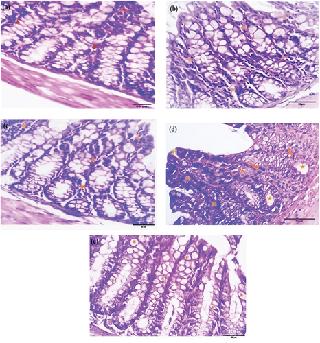 Figure 2. Photomicrograph of colorectal sections post-6 weeks through the mucosa layer showing the epithelium of (a) EDTA, (b) DMSO, and (c) Nic groups with scattered inflammatory cells (arrowheads), (d) DMH group with hyperchromasia (H), dysplastic cells (arrows), and goblet cell reduction (stars), and (e) Nic-DMH group with rich goblet cells (asterisks). (H&E stain, scale bar: 50 µm).