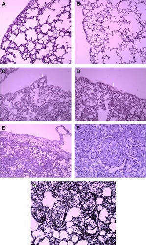 Figure 4 Pathological examinations of pleural membranes and the lungs.Notes: (A, B) In the control groups (saline and polyacrylate), there were no changes in appearance and micromorphology of lung and pleural membrane (hematoxylin and eosin ×100). (C) Pulmonary image from a rat in the low-dose group on day 7. Slight alveolar septum thickening and lymphocytic infiltrations were observed with slight hyperplasia of mesothelial cells in the visceral pleura (hematoxylin and eosin ×100). (D) Pulmonary image from a rat in the intermediate-dose group on day 7, apparent alveolar septum thickening and lymphocytic infiltrations were observed as well as hyperplasia of mesothelial cells in the visceral pleura (hematoxylin and eosin ×100). (E, F) Pulmonary image from a rat in the high-dose group. Pulmonary epithelial hyperplasia and alveolar septum thickening and granulomas, as well as pleural thickening and lymphocytic infiltrations in the visceral pleura (E, hematoxylin and eosin ×100; F, hematoxylin and eosin ×200). (G) Reticular fiber staining showed that reticular fibers enwrapped granulation tissue demonstrating the structure of granulomas (×200). Edema and lymphocytic infiltrations in the visceral pleura are indicated by the arrows.