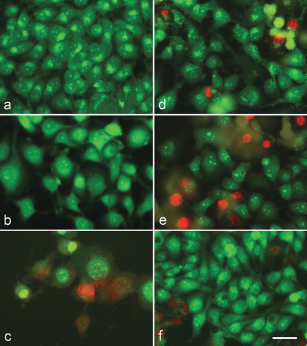 Figure 4. A complete monolayer of HeLa human cervical carcinoma cells with bright yellow-green nucleoli and bright yellow-green granular accumulations within the cytoplasm – culture medium control (a); HeLa cells 72 h following the treatment with с 500 µg/mL meloxicam (b); 500 µg/mL Cu-meloxicam (c); 500 µg/mL Zn-meloxicam (d); 500 µg/mL Co-meloxicam (e) and 500 µg/mL Ni-meloxicam (f). Note: Cell swelling with increasing of intercellular spaces (b); moderate cell losses (c), as well as appearing of dead cells (red nuclei) (c, d, e and f). Acridine orange – propidium iodide staining. Bar = 50 µm.