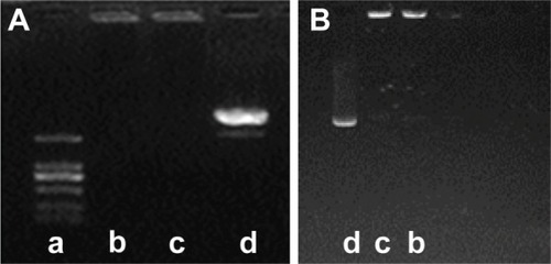 Figure 3 Gel electrophoresis of pEGFP-loaded particles before (A), and after (B) being digested by DNase I.Notes: Gel line (a) represents DNA marker 2000; line (b) represents pEGFP-loaded TACS-HBC composite particles; line (c) represents pEGFP-loaded TACS core particles; and line (d) represents naked pEGFP. Line identification scheme applies to both (A) and (B).Abbreviations: pEGFP, enhanced green fluorescent protein plasmids; DNase I, deoxyribonuclease I; DNA, deoxyribonucleic acid; TACS, thiolated N-alkylated chitosan; HBC, hydroxybutyl chitosan.